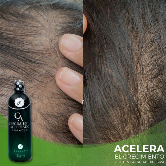 SHAMPOO CRECIMIENTO ACELERADO + OBSEQUIO (PERFUME CAPILAR)